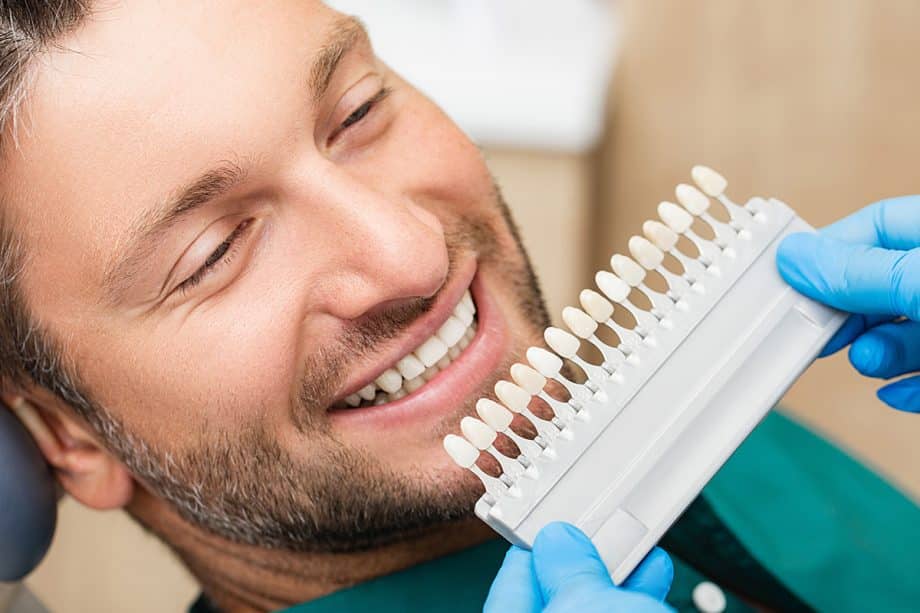 Are Veneers Permanent