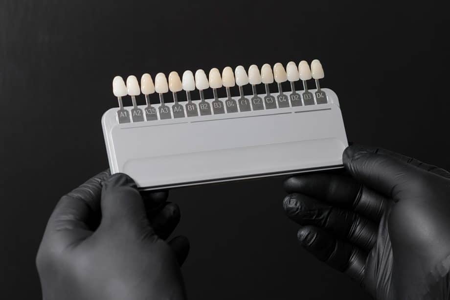 Do You Need Cosmetic Dentistry or Orthodontics? A Quick Comparison