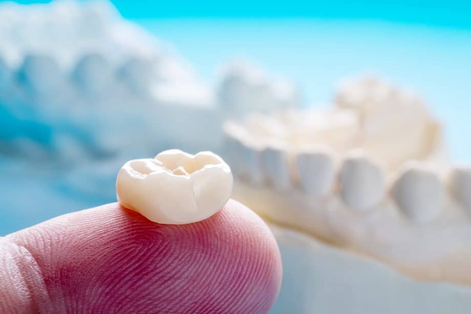 How Long Does It Take To Get A Dental Crown?