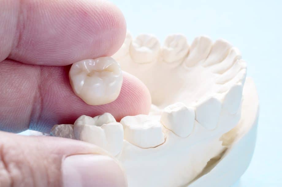 How Much Does A Dental Crown Cost In Snellville, GA?