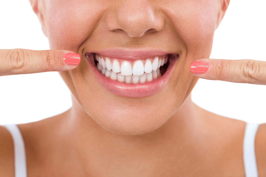 How Much Is Teeth Whitening in Snellville, GA?