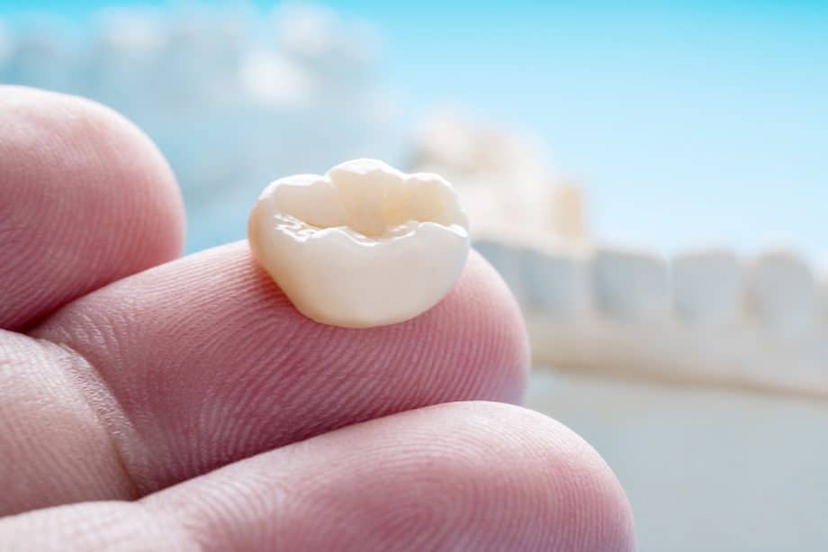 The Step-by-Step Process of Getting a Same-Day Crown