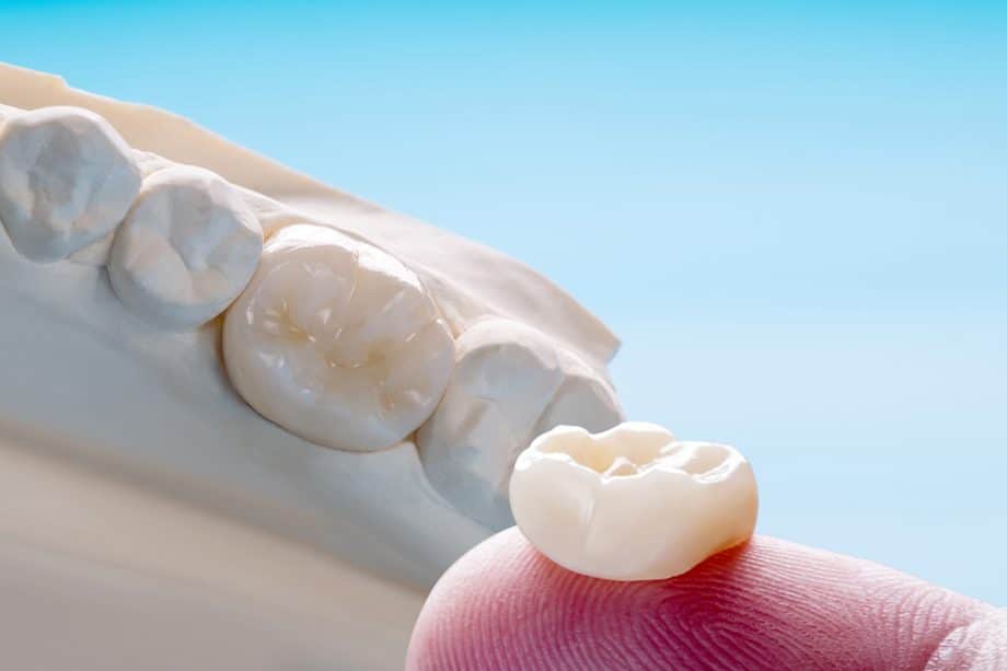 What Are the Advantages of CEREC Same-Day Crowns in Snellville, GA?