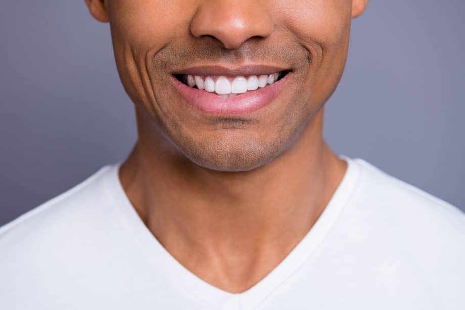 close up of a man's teeth after whitening